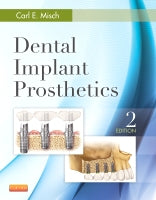 Dental Implant Prosthetics 2e