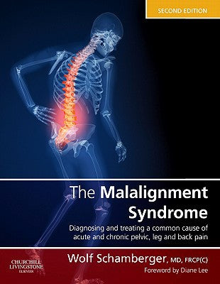 Malalignment Syndrome,The:diagnosis and treatment of common pelvic and