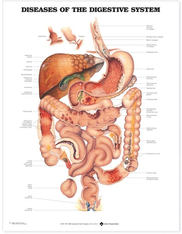 Diseases of the Digestive System Anatomical Chart Laminated
