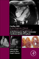 Cardiac MRI in Diagnosis, Clinical Management and Prognosis of  Arrythmogenic Right Ventricular Dysplasia/Cardiomyopathy