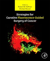 Strategies for curative fluorescence-guided surgery of cancer