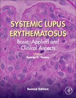 Systemic Lupus Erythematosus: Basic, Applied and Clinical Aspects