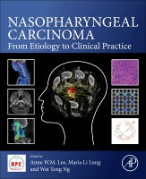 Nasopharyngeal Carcinoma: From Aetiology to Clinical Practice