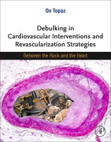 Debulking Cardiovascular Interventions and Revascularization Strategies: Between the Rock and the Heart
