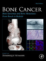 Bone Cancer, 3E