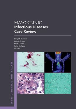 Mayo Clinic Infectious Disease Case Review With Board-Style Questions & Answers