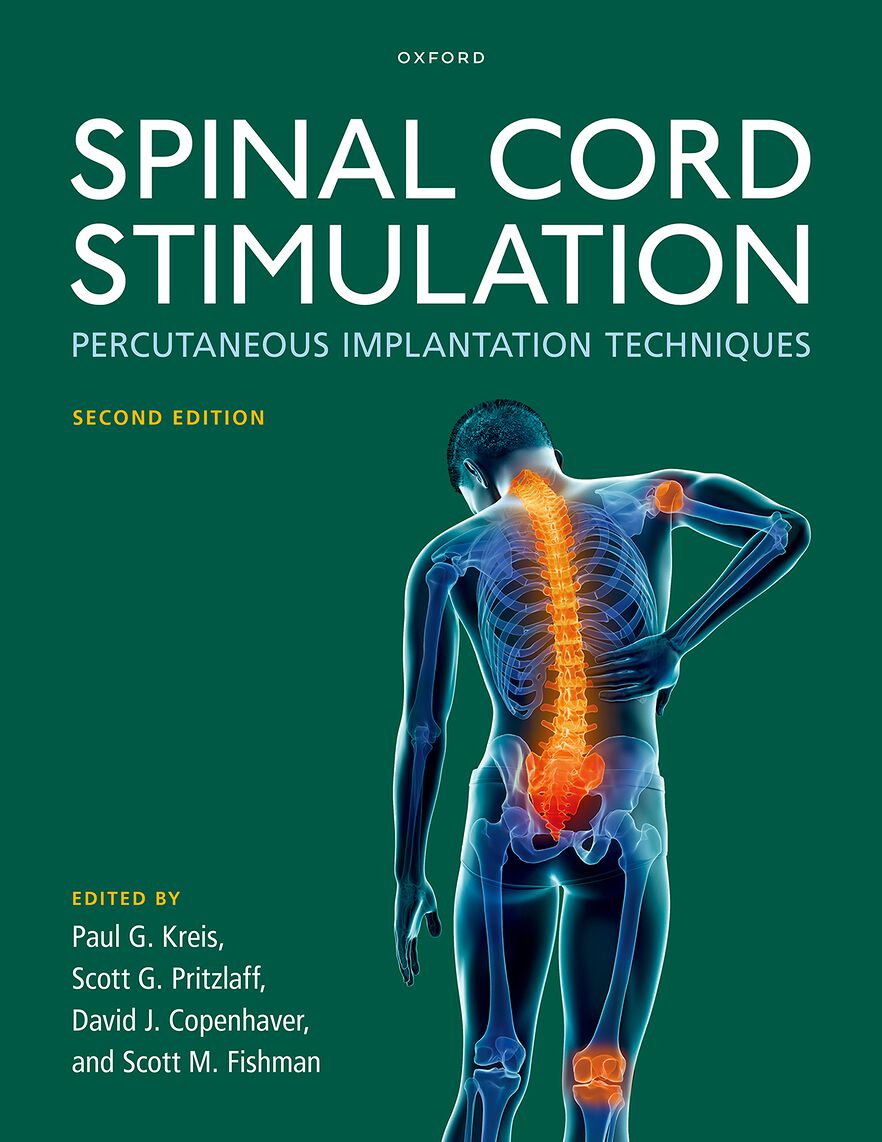 Spinal Cord Stimulation Percutaneous Implantation Techniques