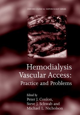 Hemodialysis Vascular Access