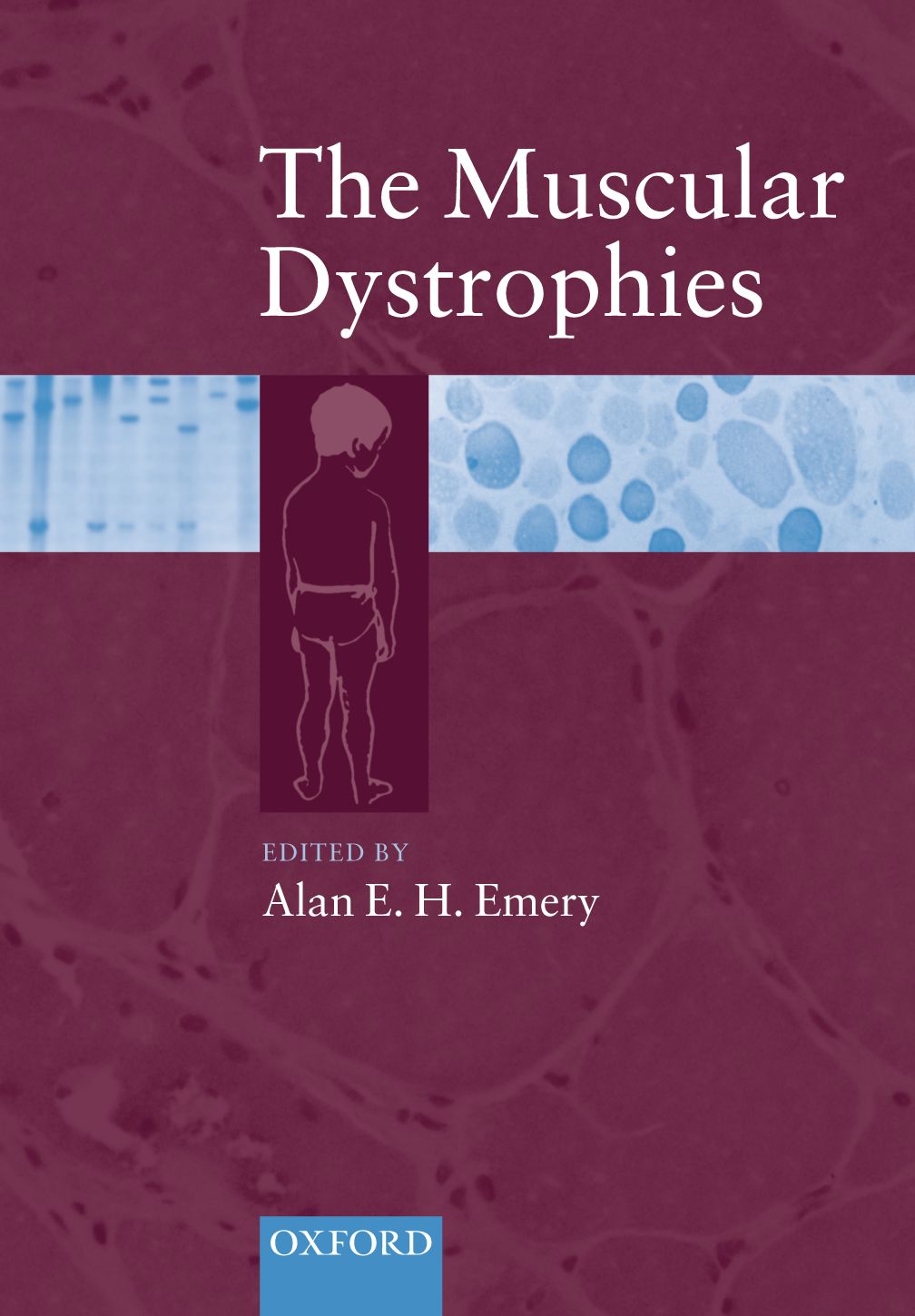 Muscular Dystrophies, The