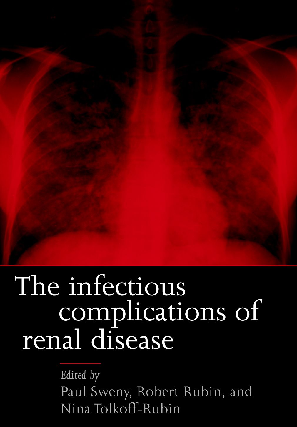 Infectious Complications of Renal Disease