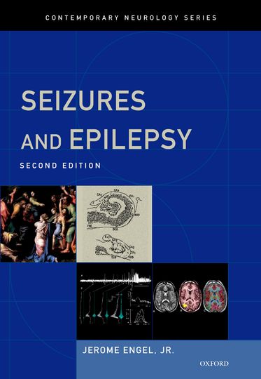 Seizures and Epilepsy