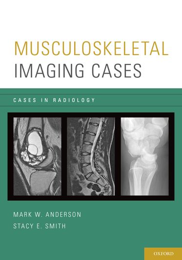 Musculoskeletal Imaging Cases