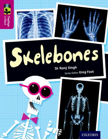 TreeTops InFact Level 10 Skelebones