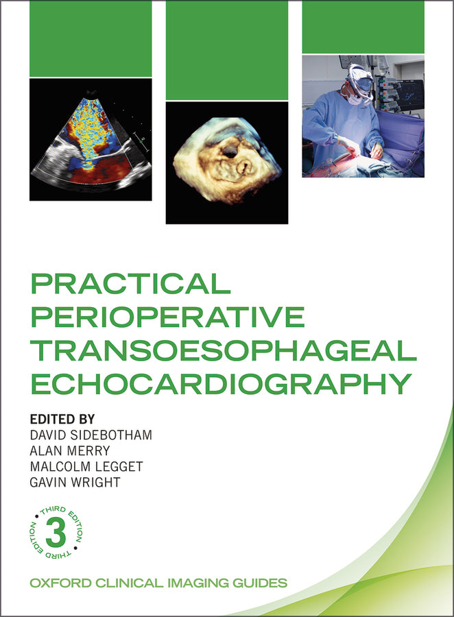 Practical Perioperative Transoesophageal Echocardiography