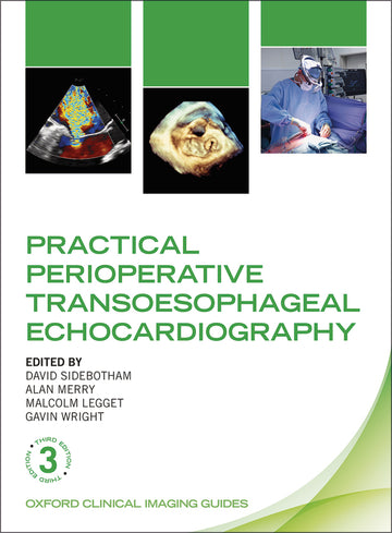 Practical Perioperative Transoesophageal Echocardiography