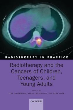 Radiotherapy and the Cancers of Children Teenagers and Young Adults