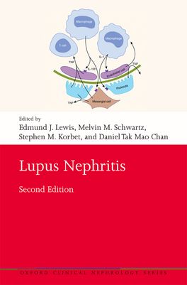 Lupus Nephritis