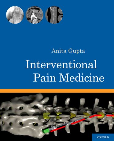 Interventional Pain Medicine