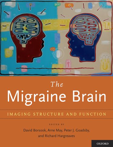 The Migraine Brain