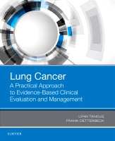 Lung Cancer: Evidence-Based Clinical Evaluation and Management