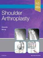 Shoulder Arthroplasty 2E