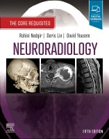 Neuroradiology: Core Requisites