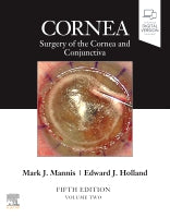 PART - Cornea, Volume 2
