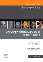 Advanced Neuroimaging in Brain Tumors, An Issue of Radiologic Clinics of North America