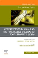 Controversies in Managing the Flatfoot Deformity, An issue of Foot and Ankle Clinics of North America
