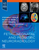 Fetal and Pediatric Neuroradiology Companion