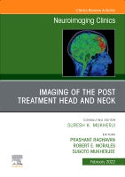 Post Treatment Head and Neck, An Issue of Neuroimaging Clinics of North America