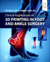 Clinical Application of 3D Printing in Foot & Ankle Surgery