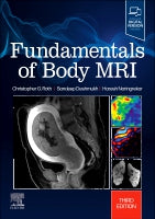 Fundamentals of Body MRI