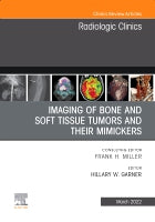 Imaging of Bone and Soft Tissue Tumors and Mimickers, An Issue of Radiologic Clinics of North America