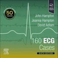 150 ECG Cases