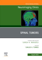 Spine Tumors, An Issue of Neuroimaging Clinics of North America