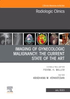 Gynecologic Malignancy, An Issue of Radiologic Clinics of North America