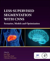 Less-supervised Segmentation with CNNs: Scenarios, Models and Optimization.