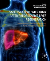 Safe Major Hepatectomy after Preoperative Liver Regeneration: Preopearative PVE, Two-Satage Hepatetomy, ALPPS and Hepati