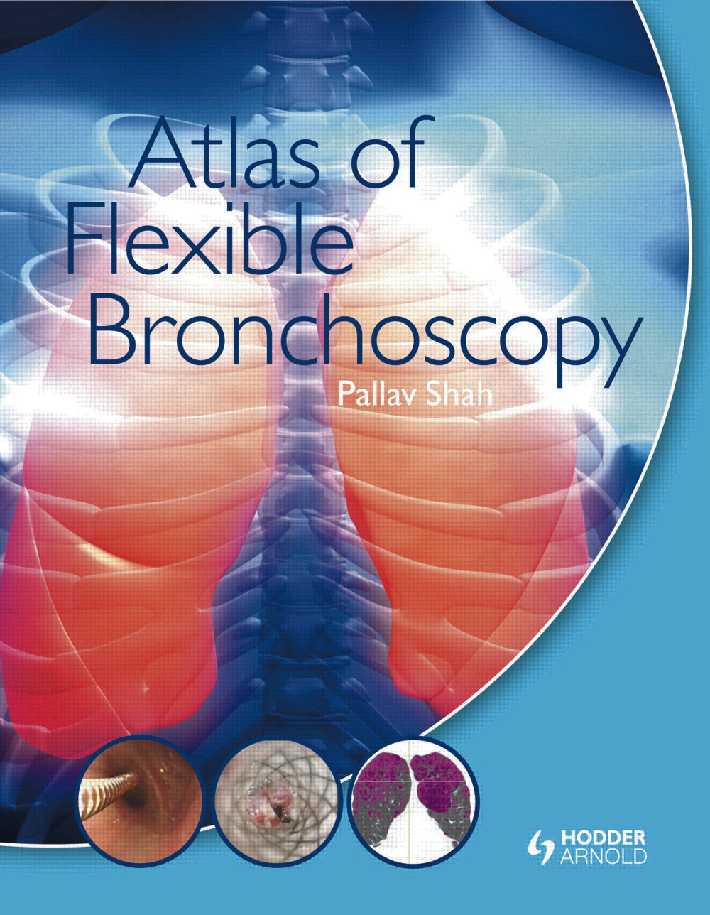 Atlas of Flexible Bronchoscopy