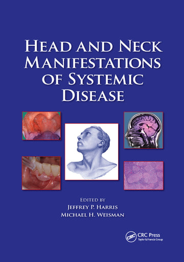 Head and Neck Manifestations of Systemic Disease