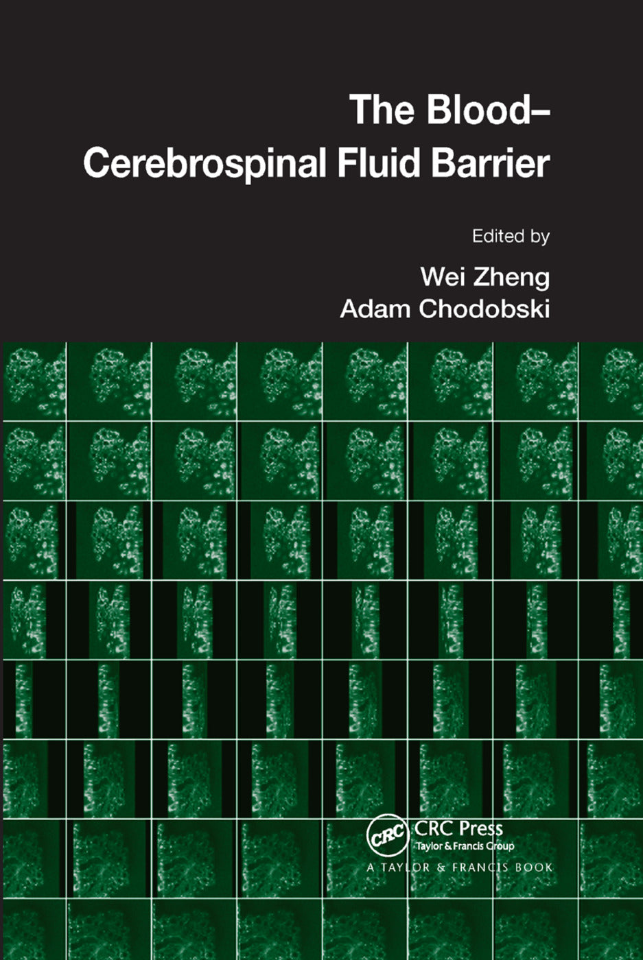 Blood-Cerebrospinal Fluid Barrier