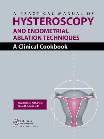 Practical Manual of Hysteroscopy and Endometrial Ablation Techniques