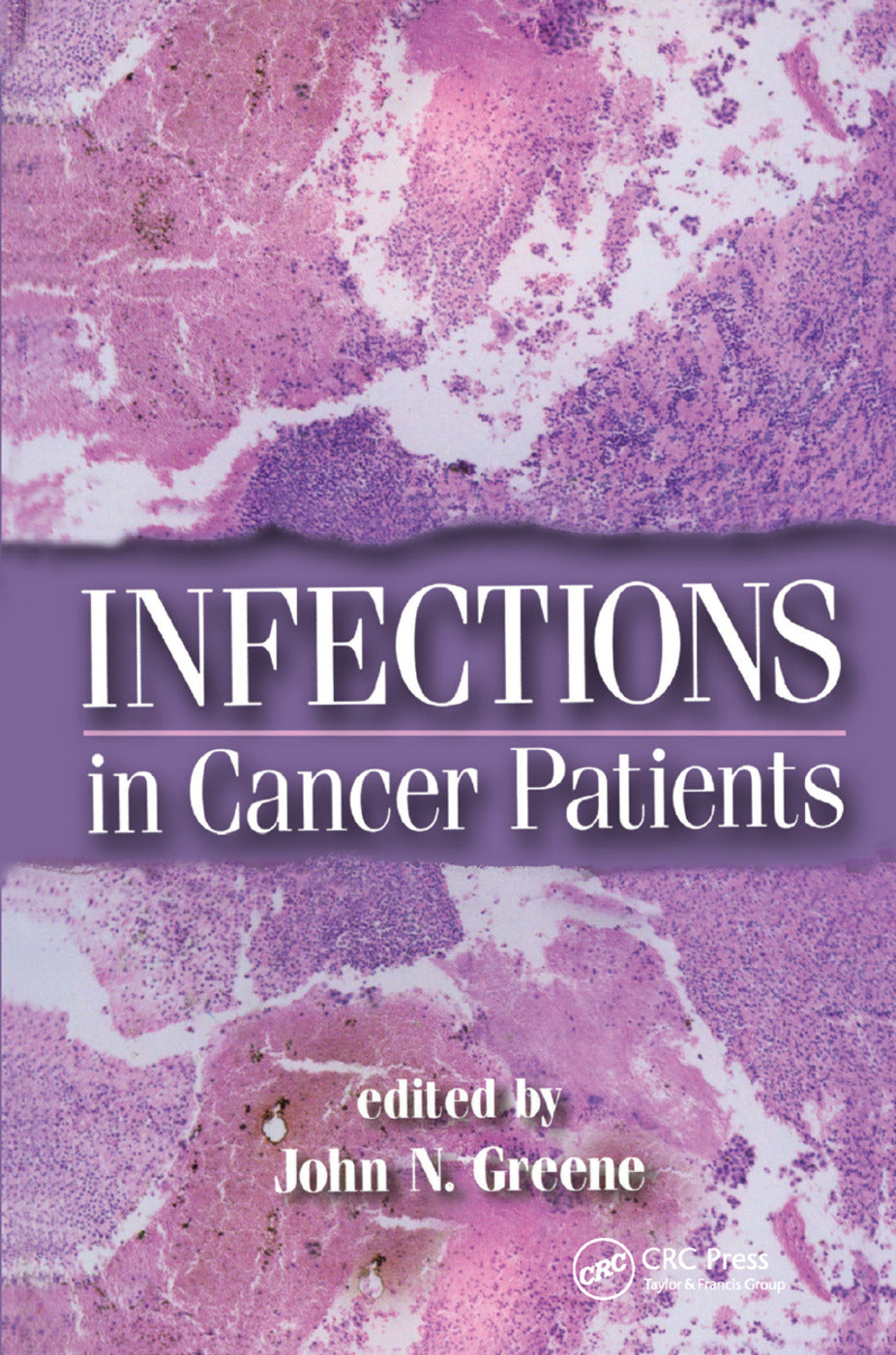 Infections in Cancer Patients