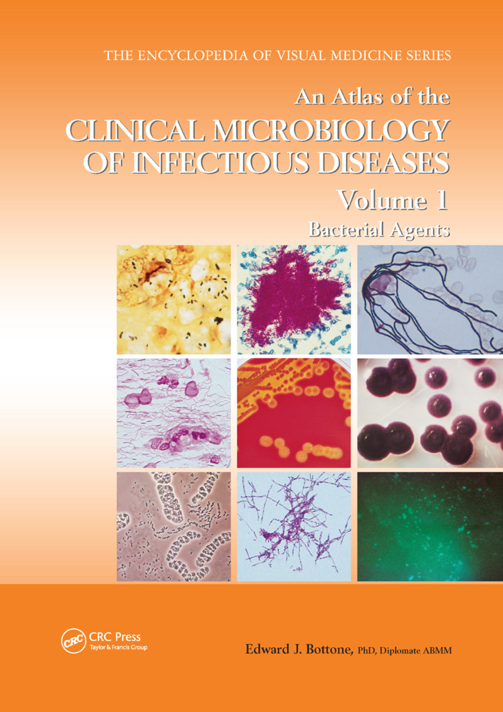 Atlas of the Clinical Microbiology of Infectious Diseases, Volume 1