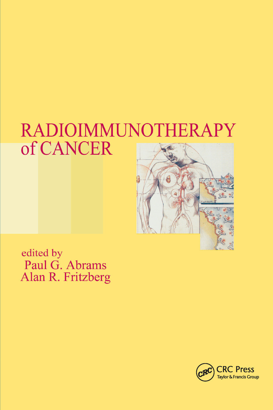 Radioimmunotherapy of Cancer