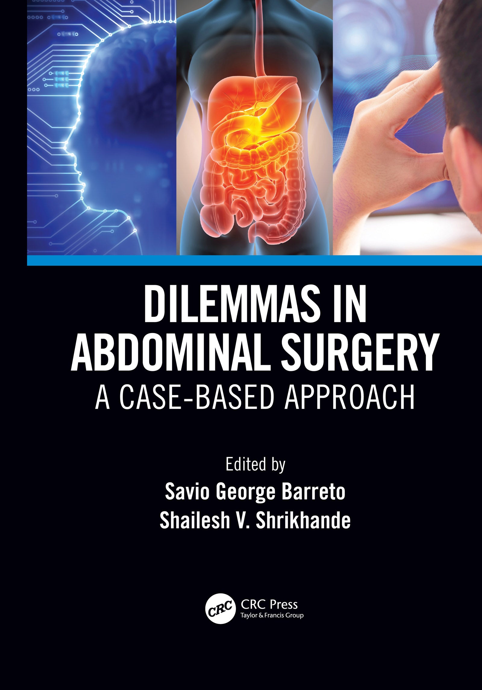 Dilemmas in Abdominal Surgery