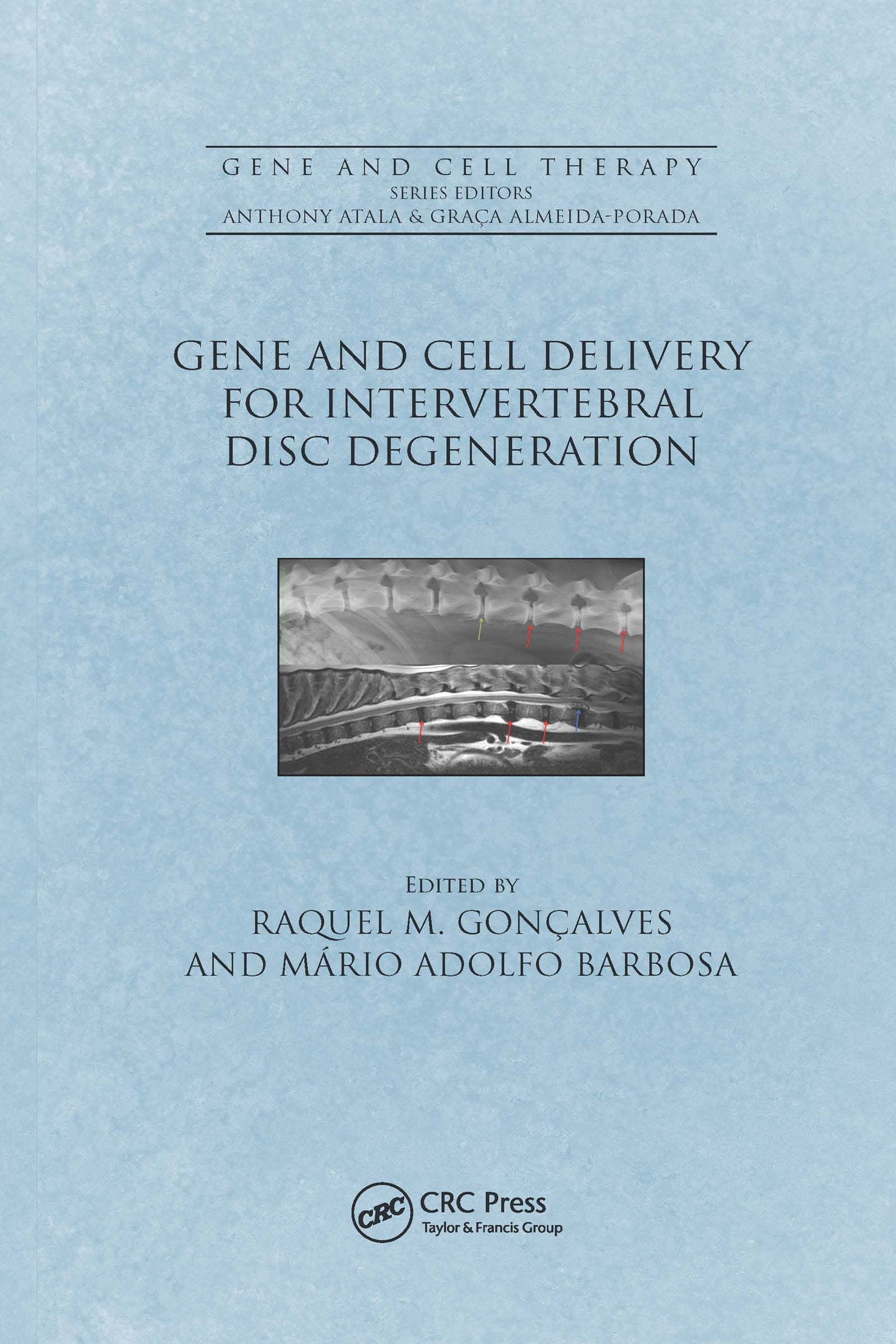 Gene and Cell Delivery for Intervertebral Disc Degeneration