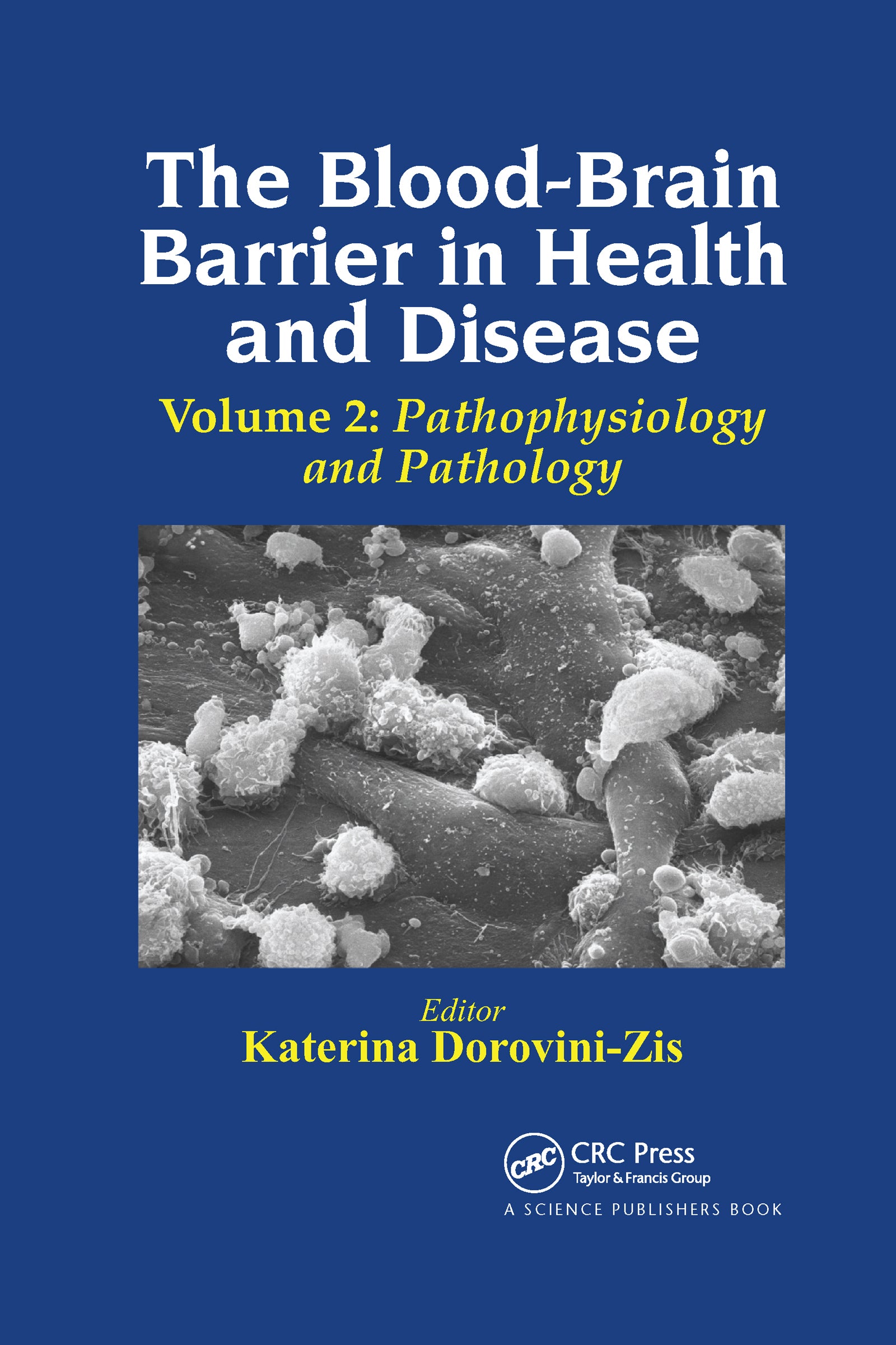 Blood-Brain Barrier in Health and Disease, Volume Two