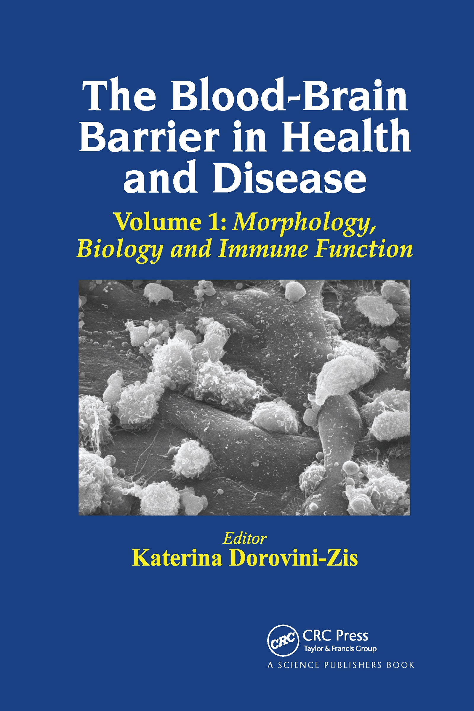 Blood-Brain Barrier in Health and Disease, Volume One